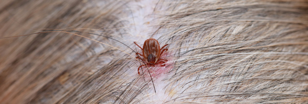 Что делать, если клещ укусил