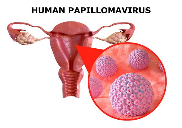Вирус папилломы человека — риск рака шейки матки