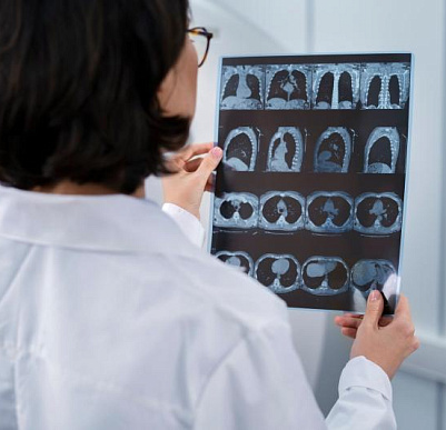 Главные отличия МРТ и рентгена