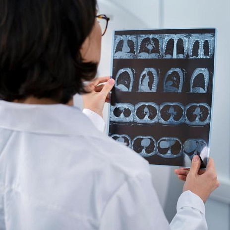 Главные отличия МРТ и рентгена