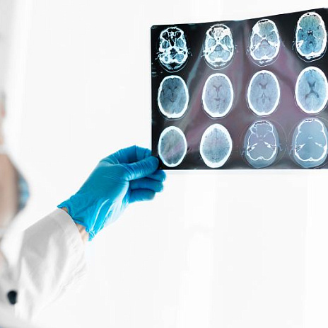 Что означают пятна на МРТ головного мозга?