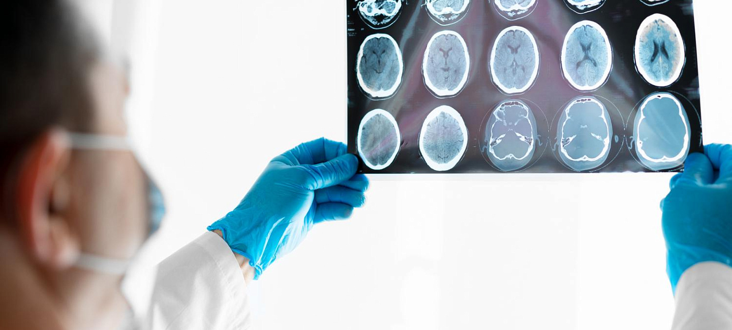Что означают пятна на МРТ головного мозга?