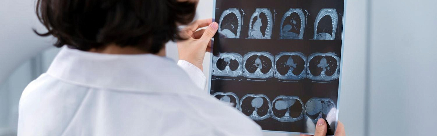 Главные отличия МРТ и рентгена