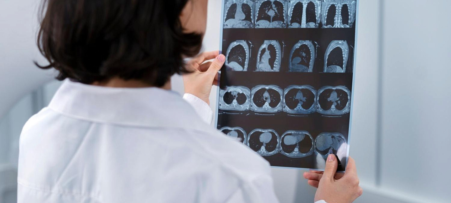 Главные отличия МРТ и рентгена